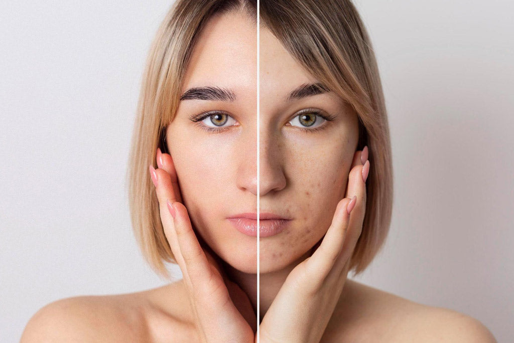 Top Cleansers for Combination Skin You’ll Love