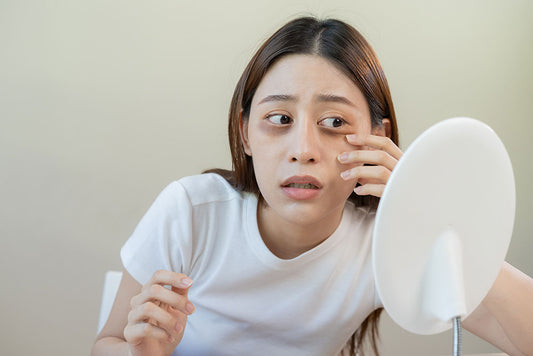 The Best Under Eye Cream for Dark Circles that actually works!