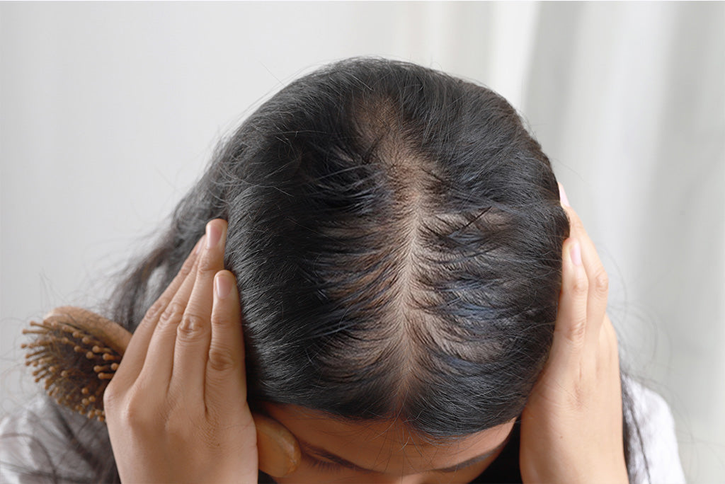 Control Hair Loss With The Best Shampoos