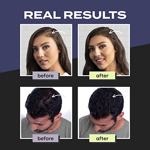 Toppik Hair Fibers Black 55 gm