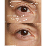 Dr. Lancer Eye Contour Lifting Cream 15ml